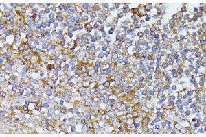 Immunohistochemistry of paraffin-embedded Human tonsil using EIF2B2 Polyclonal Antibody at dilution of 1:100 (40x lens). (EIF2B2 anticorps)