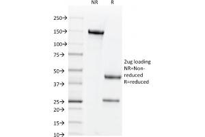 SDS-PAGE Analysis Purified CD44v6 Mouse Monoclonal Antibody (CD44V6/2496). (CD44 anticorps)