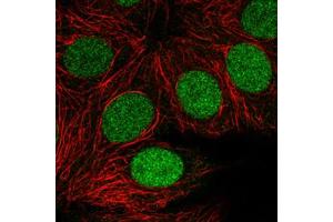 Immunofluorescent staining of MCF7 cells with PARP1 monoclonal antibody, clone CL2220  (Green) shows clear cycle dependent nuclear.