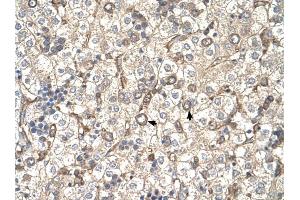 ST3GAL4 antibody was used for immunohistochemistry at a concentration of 4-8 ug/ml to stain Hepatocytes (arrows) in Human Liver. (ST3GAL4 anticorps  (Middle Region))
