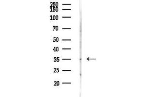 Western blot analysis of lysates from 293 cells(UV,30 min treatment), using OR5H1 Antibody at 1/1000 dilution.