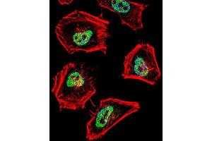 Immunofluorescence (IF) image for anti-Nuclear Receptor Co-Repressor 1 (NCOR1) antibody (ABIN2996086)