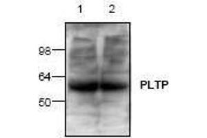 Image no. 1 for anti-Phospholipid Transfer Protein (PLTP) antibody (ABIN127227) (PLTP anticorps)