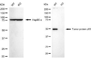 Western blotting analysis using tumor protein p53 antibody (ABIN7800687). (p53 anticorps)