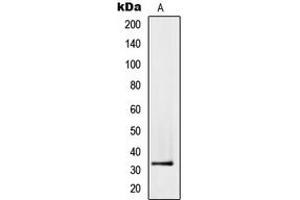 Western blot analysis of PMEPA1 expression in PC3 (A) whole cell lysates. (PMEPA1 anticorps  (Center))