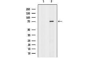 anti-Inosine 5'-Phosphate Dehydrogenase 1 (IMPDH1) (C-Term) antibody