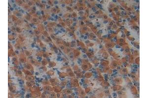 Detection of LIFR in Rat Stomach Tissue using Polyclonal Antibody to Leukemia Inhibitory Factor Receptor (LIFR)