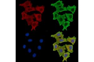 ABIN7096107 and ABIN7100169 staining HepG2 cells by IF/ICC.