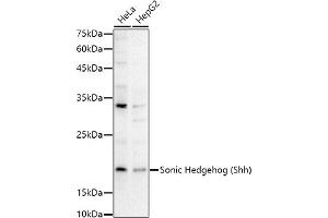 Western blot analysis of extracts of various cell lines, using Sonic Hedgehog (Shh) antibody (ABIN6134067, ABIN6147741, ABIN6147743 and ABIN6223662) at 1:1000 dilution. (Sonic Hedgehog anticorps)