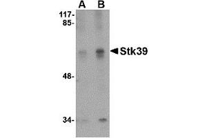 Western Blotting (WB) image for anti-serine threonine Kinase 39 (STK39) (C-Term) antibody (ABIN1030708)
