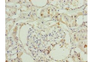 Immunohistochemistry of paraffin-embedded human kidney tissue using ABIN7142940 at dilution of 1:100 (ILVBL anticorps  (AA 45-344))