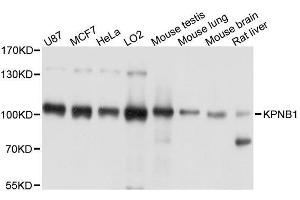 Western blot analysis of extracts of various cell lines, using KPNB1 antibody. (KPNB1 anticorps  (AA 250-350))
