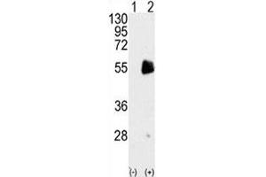 Western blot analysis of PRMT7 antibody and 293 cell lysate either nontransfected (Lane 1) or transiently transfected with the PRMT7 gene (2). (PRMT7 anticorps  (AA 660-692))