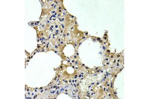 Immunohistochemistry of paraffin-embedded rat lung using HDC antibody at dilution of 1:200 (400x lens). (HDC anticorps)