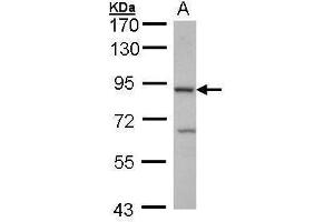 WB Image Sample (30 ug of whole cell lysate) A: Hep G2 , 7. (Cbl Proto-Oncogene B, E3 Ubiquitin Protein Ligase (CBLB) (C-Term) anticorps)