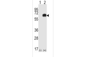 Western blot analysis of RIPK2 (arrow) using rabbit polyclonal RIPK2 Antibody  (ABIN392274 and ABIN2841944).