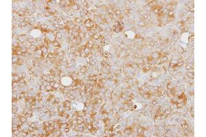 IHC-P Image Immunohistochemical analysis of paraffin-embedded SW480 xenograft, using Caspase 1 alpha, antibody at 1:100 dilution.