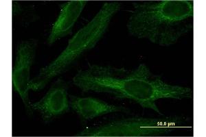 Immunofluorescence of monoclonal antibody to PDE4C on HeLa cell. (PDE4C anticorps  (AA 1-99))