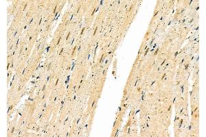 ABIN6261695 and ABIN6277334 at 1/100 staining Rat heart tissue by IHC-P. (FBXO32 anticorps  (N-Term))