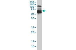 IRF5 monoclonal antibody (M03), clone 1H6 Western Blot analysis of IRF5 expression in A-431 .