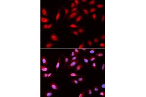 Immunofluorescence analysis of U2OS cell using PDPK1 antibody.