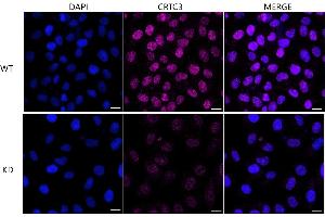 Immunocytochemical staining of HeLa cells using CRTC3 antibody (ABIN7798167), 1:1,000), Top panel: wild-type (WT), Bottom panal: CRTC3 shRNA knockdown (KD).