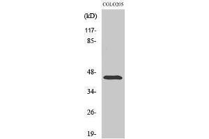 Western Blotting (WB) image for anti-Abhydrolase Domain Containing 12 (ABHD12) (Internal Region) antibody (ABIN3173622) (ABHD12 anticorps  (Internal Region))