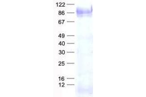 Validation with Western Blot (SP1 Protein (His tag))