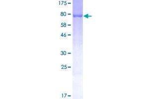 Image no. 1 for Peripherin (PRPH) (AA 1-470) protein (GST tag) (ABIN1316403)