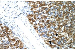 Human Liver (NFYA anticorps  (C-Term))