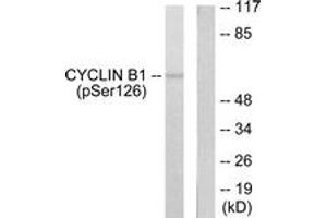 Western blot analysis of extracts from NIH-3T3 cells treated with EGF 200ng/ml 15', using Cyclin B1 (Phospho-Ser126) Antibody. (Cyclin B1 anticorps  (pSer126))
