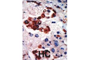 Immunohistochemistry (IHC) image for anti-Protein Kinase C, iota (PRKCI) antibody (ABIN3002935) (PKC iota anticorps)