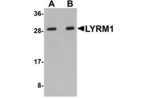 Western blot analysis of LYRM1 in human liver tissue lysate with LYRM1 antibody at (A) 1 and (B) 2 μg/ml. (LYRM1 anticorps  (Center))