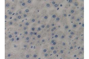Detection of C7 in Rat Liver Tissue using Polyclonal Antibody to Complement Component 7 (C7)