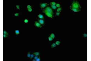Immunofluorescent analysis of PC-3 cells using ABIN7143291 at dilution of 1:100 and Alexa Fluor 488-congugated AffiniPure Goat Anti-Rabbit IgG(H+L)