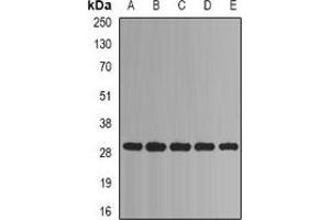 Western blot analysis of PSMA1 expression in Jurkat (A), Hela (B), HepG2 (C), mouse liver (D), mouse heart (E) whole cell lysates. (PSMA1 anticorps)
