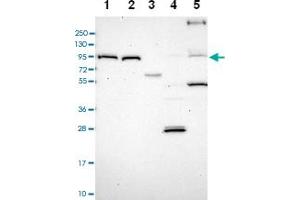Western blot analysis of Lane 1: RT-4 Lane 2: U-251 MG Lane 3: Human Plasma Lane 4: Liver Lane 5: Tonsil with TRPV2 polyclonal antibody .