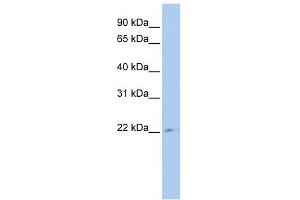 TUSC1 antibody used at 1 ug/ml to detect target protein. (TUSC1 anticorps  (Middle Region))
