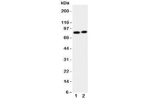 Western blot testing of Gelsolin antibody and Lane 1: HeLa;  2: A431 cell lysate. (Gelsolin anticorps  (AA 763-775))