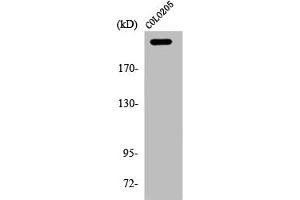 Western Blot analysis of COLO205 cells using APC Polyclonal Antibody
