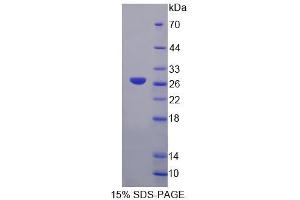 SDS-PAGE analysis of Human GFM2 Protein. (GFM2 Protéine)
