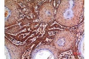 Immunohistochemistry (IHC) analysis of paraffin-embedded Human Skin, antibody was diluted at 1:100. (alpha 2 Macroglobulin anticorps  (Internal Region))
