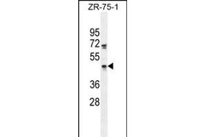 ZN Antibody (C-term) (ABIN655256 and ABIN2844853) western blot analysis in ZR-75-1 cell line lysates (35 μg/lane). (ZNF578 anticorps  (C-Term))