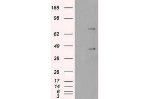 Image no. 5 for anti-Sjogren Syndrome Antigen B (SSB) antibody (ABIN1501143)