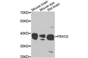 Western blot analysis of extracts of various cell lines, using FBXO2 antibody (ABIN5995854) at 1/1000 dilution.