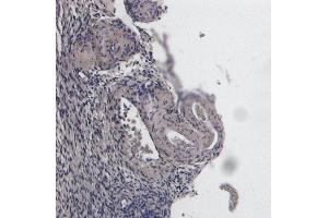 (ABIN185040) Negative Control showing staining of paraffin embedded Human Ovary, with no primary antibody.