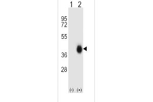 Western blot analysis of FCAR (arrow) using rabbit polyclonal FCAR Antibody (Center) (ABIN656839 and ABIN2846047). (FCAR anticorps  (AA 58-84))