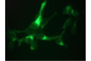 Immunofluorescent staining of LNCaP cells.
