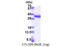 SDS-PAGE (SDS) image for Ribosomal Protein S4, X-Linked (RPS4X) (AA 1-263) protein (His tag) (ABIN5853413)
