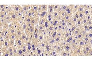 Detection of ALPL in Mouse Liver Tissue using Polyclonal Antibody to Alkaline Phosphatase, Tissue-nonspecific (ALPL)